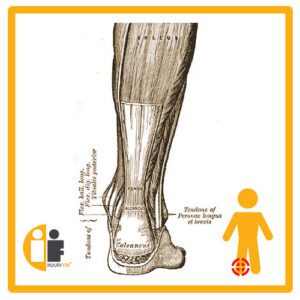 Achilles Tendon Injury Fix